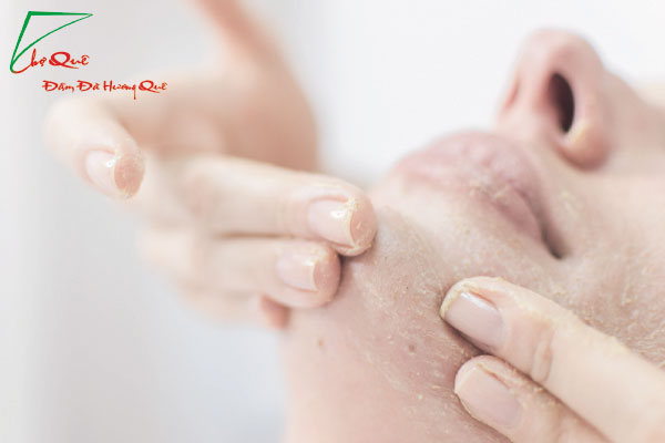 BÍ QUYẾT LÀM ĐẸP BẤT NGỜ TỪ “BỘT SẮN DÂY”